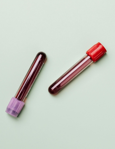 Androloogia-Uroloogia - analüüsid, uuringud ja protseduurid